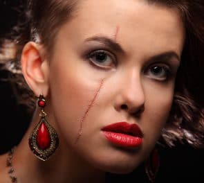 Have faced red facial scars Red facial scars apologise, but
